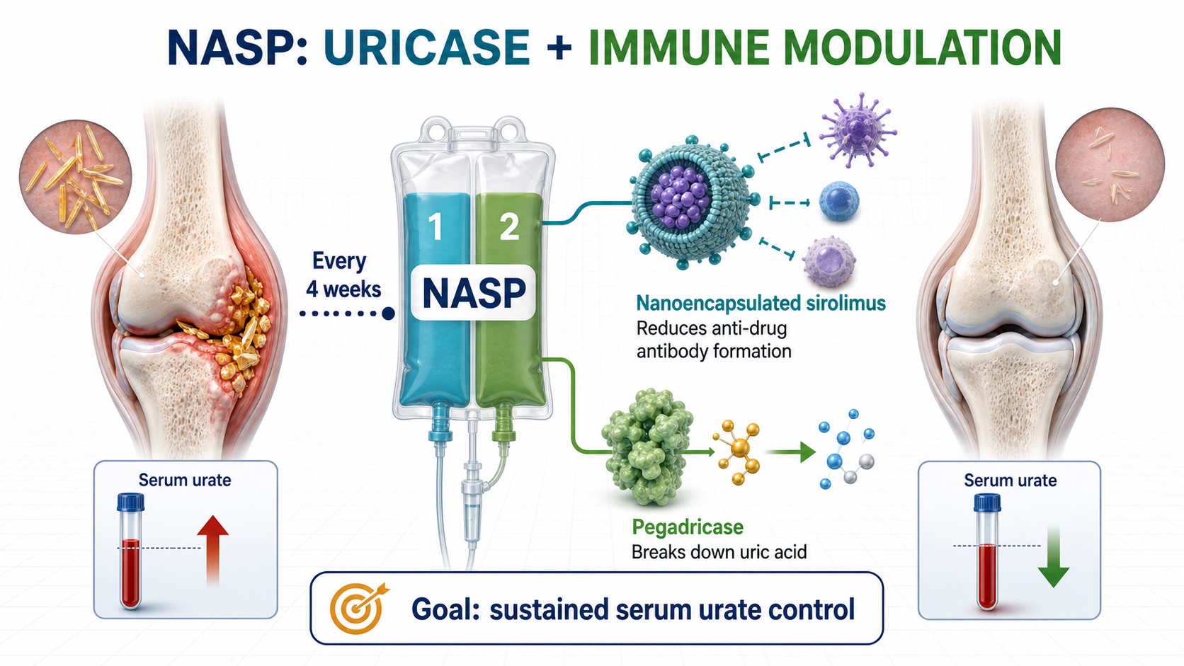 Figure 1 | NASP combines nanoencapsulated sirolimus with pegadricase to pair immune modulation with uric acid breakdown