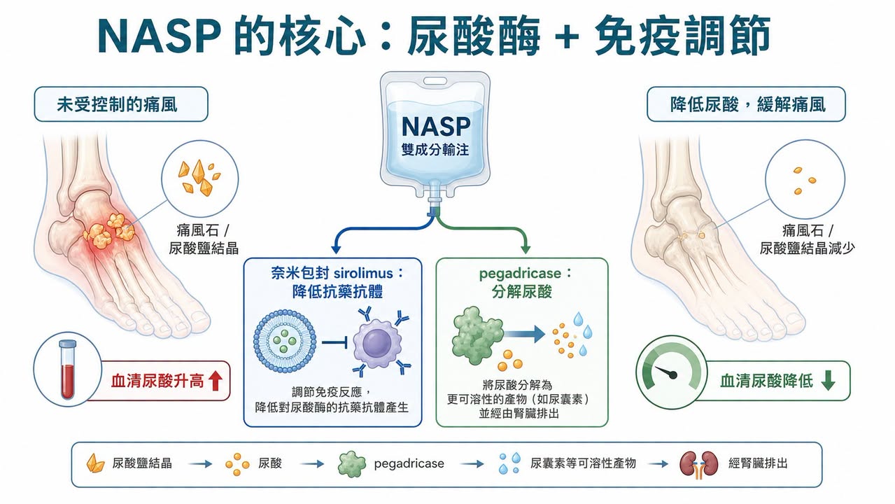 NASP 以奈米包封 sirolimus 搭配 pegadricase,兼顧免疫調節與尿酸分解