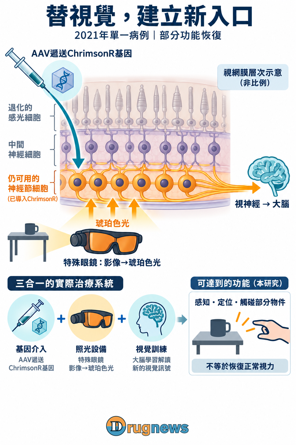 2021單一RP病例：AAV遞送ChrimsonR、琥珀光眼鏡與訓練；部分功能，非正常視力。
