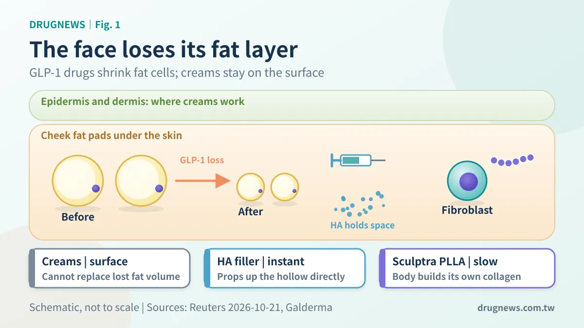 Fig. 1｜The volume lost is in the fat layer