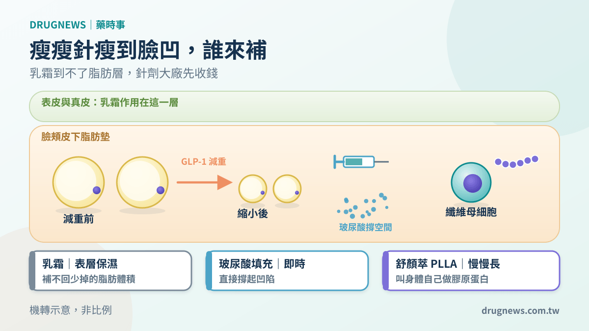 機轉示意圖:GLP-1 讓臉頰脂肪細胞縮小,乳霜只到表皮,玻尿酸與 PLLA 膠原刺激劑打進皮下補回體積