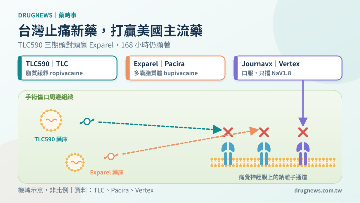 機制示意圖:TLC590、Exparel 與 Journavx 都阻斷痛覺神經上的鈉離子通道